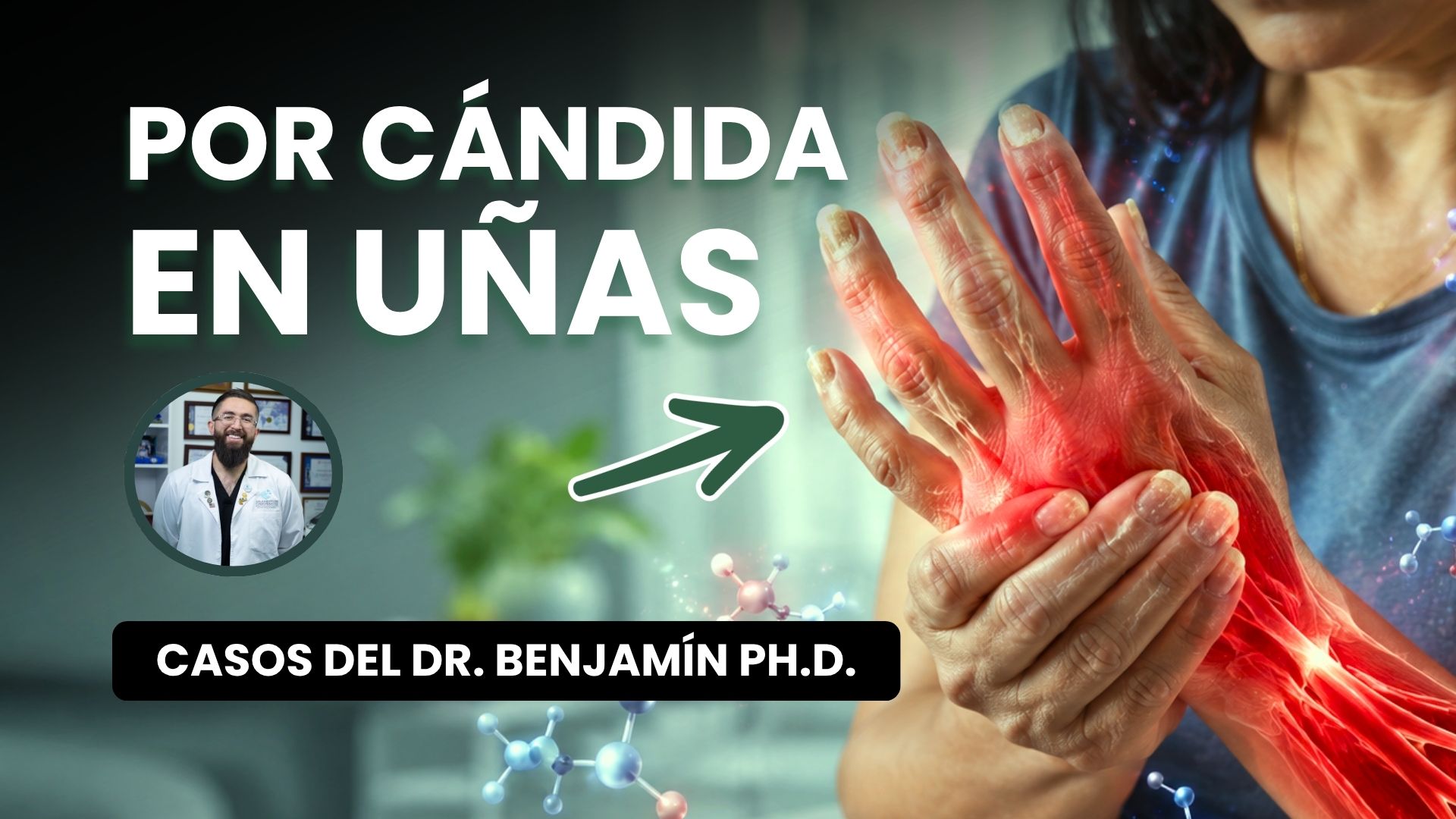 Cándida género uñas débiles