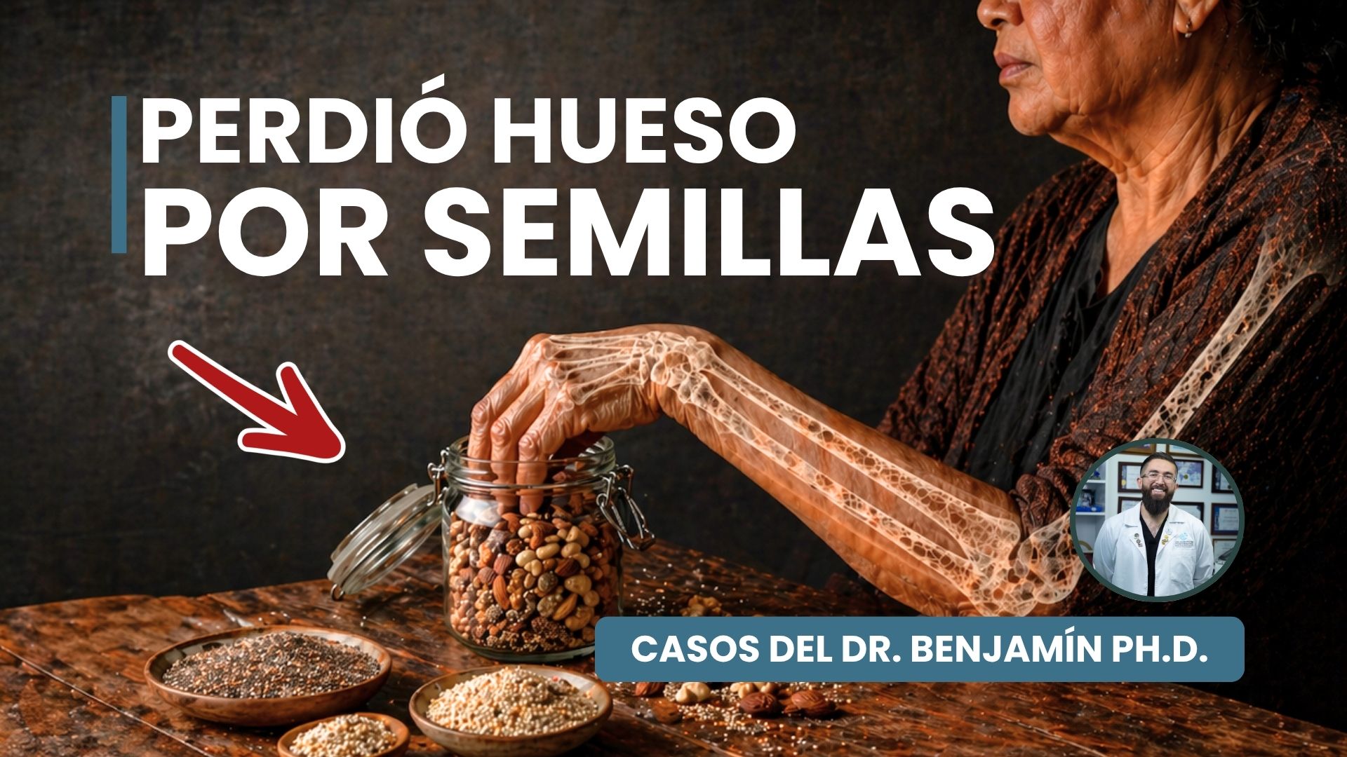 Perdió hueso por mezclar semillas (1)